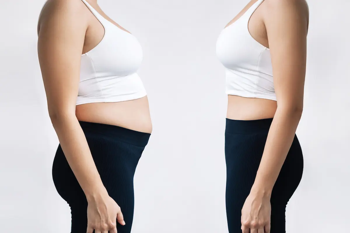 Prima e dopo perdita peso con dieta per donna Prima e dopo donna dimagrita con piano nutrizionale dedicato